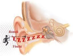 Disturbi dell'orecchio
