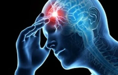 Ictus: sintomi, trattamento Ictus: sintomi, trattamento