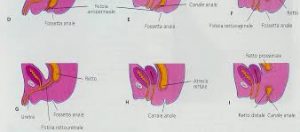 Malformazioni neonatali