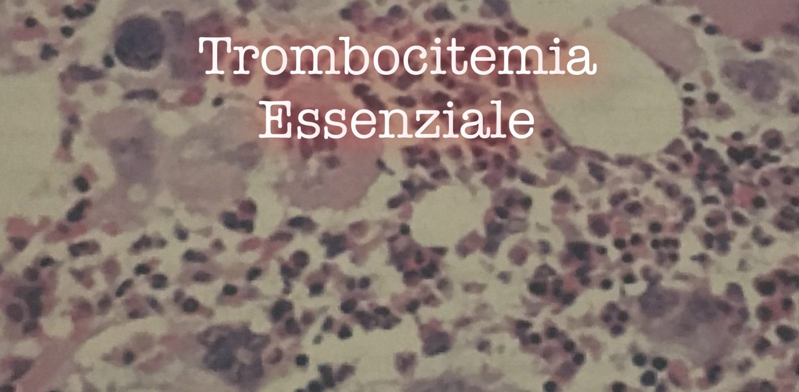 Trombocitemia essenziale