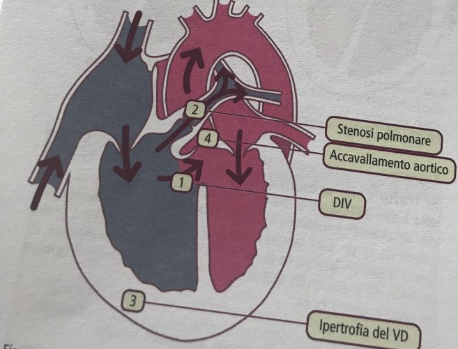 Cardiopatie congenite