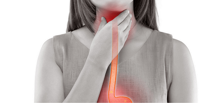 L'acalasia è una costrizione dello sfintere gastroesofageo,con dilatazione secondaria dell'esofago. L'acalasia è una malattia rara che colpisce soggetti giovani. La causa dell'acalasia sono ignote. La terapia dell'acalasia consiste nella dilatazione pneumatica.
