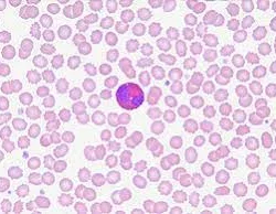 Gli eosinofili sono un tipo di globuli bianchi, o leucociti, presenti nel sangue e in alcuni tessuti del corpo.Gli eosinofili prendono il nome dal fatto che contengono granuli di un colorante chiamato eosina, che può essere visualizzato al microscopio. Gli eosinofili svolgono diverse funzioni nel sistema immunitario.