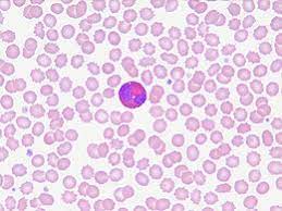 Gli eosinofili sono un tipo di globuli bianchi, o leucociti, presenti nel sangue e in alcuni tessuti del corpo.Gli eosinofili prendono il nome dal fatto che contengono granuli di un colorante chiamato eosina, che può essere visualizzato al microscopio. Gli eosinofili svolgono diverse funzioni nel sistema immunitario.