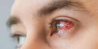 Lesioni oculari:come ridurre i rischi