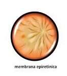 Membrana epiretinica